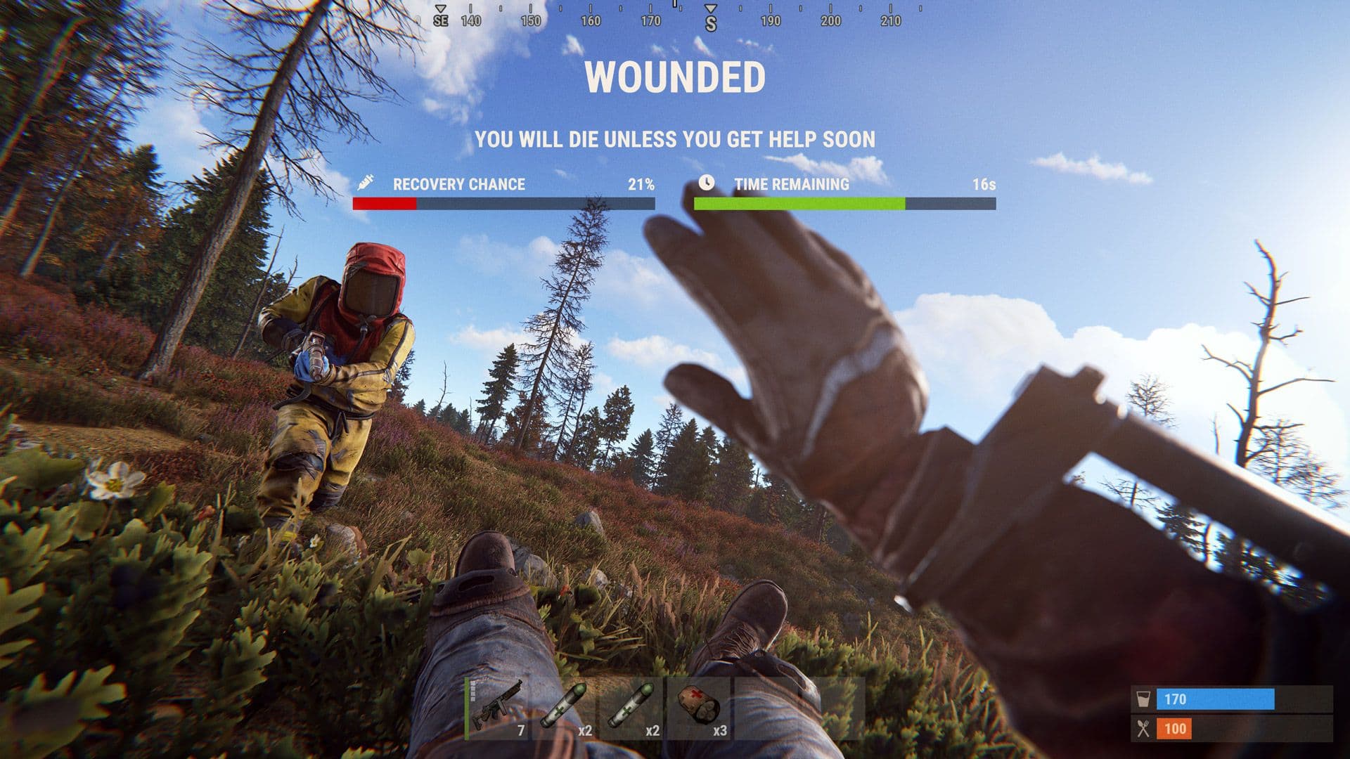 Rust wounded interface showing recovery chance and time remaining