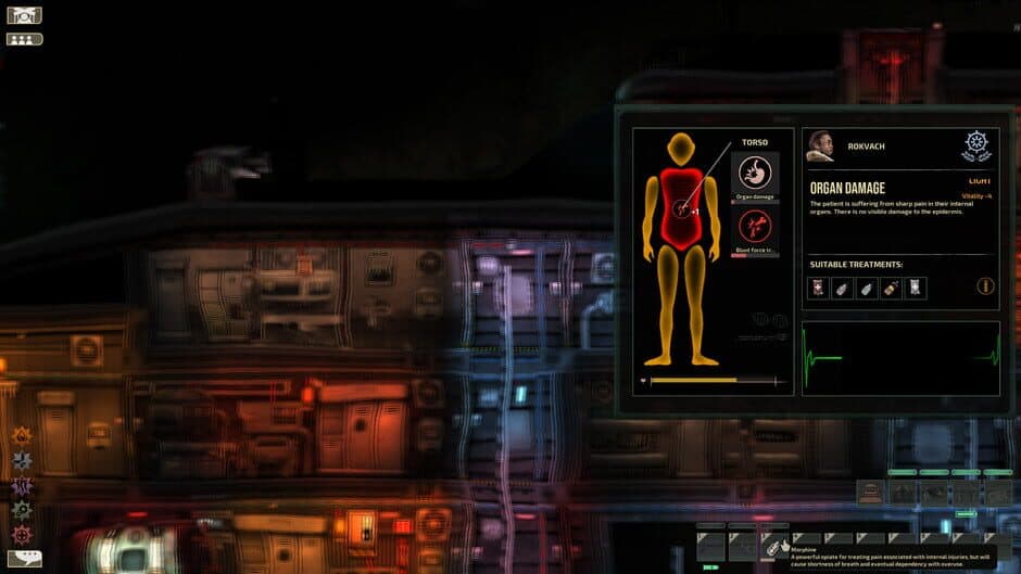 Barotrauma — 4